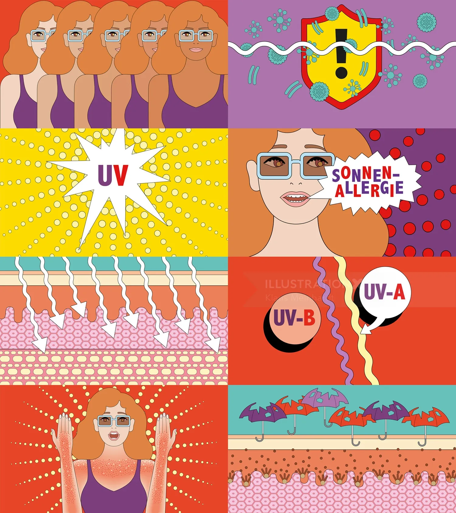 Conceptual illustrations of UV rays, sun allergy, and skin layers