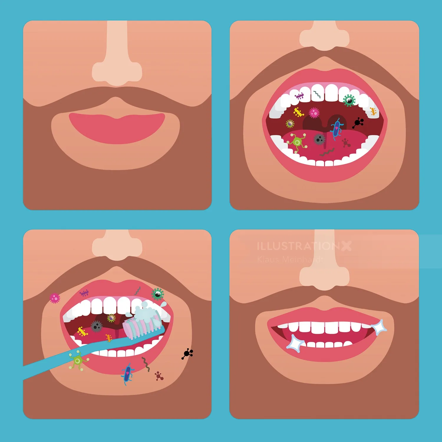 Mouth with germs, teeth brushing, and clean teeth sequence illustration