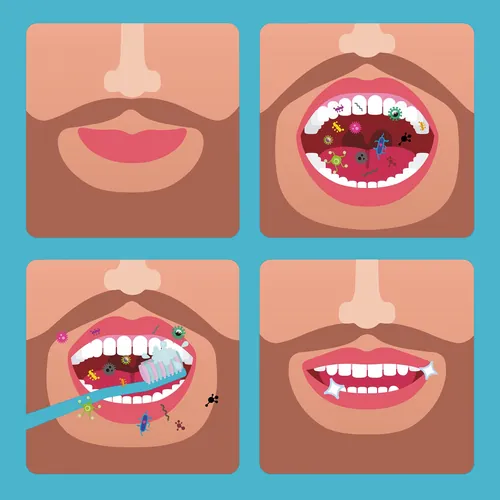 Mouth with germs, teeth brushing, and clean teeth sequence illustration