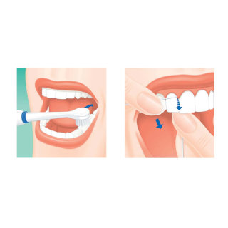 Ilustração gráfica de uso do fio dental