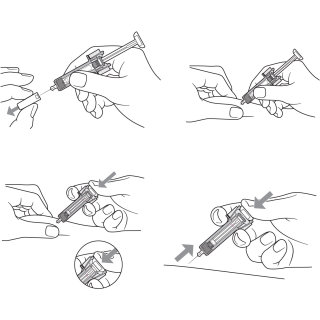 Una ilustración de la inyección.