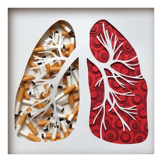 Lungs showing cigarette damage and healthy structure by Martha von Maydell