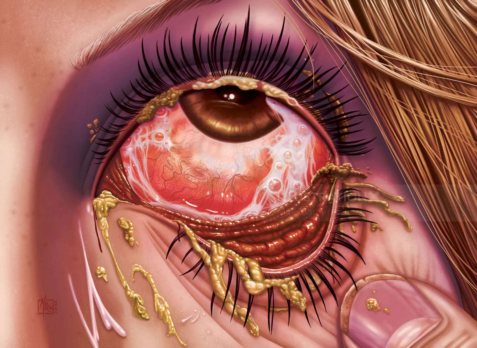 Surreal bloodshot eye artwork by Max Marin