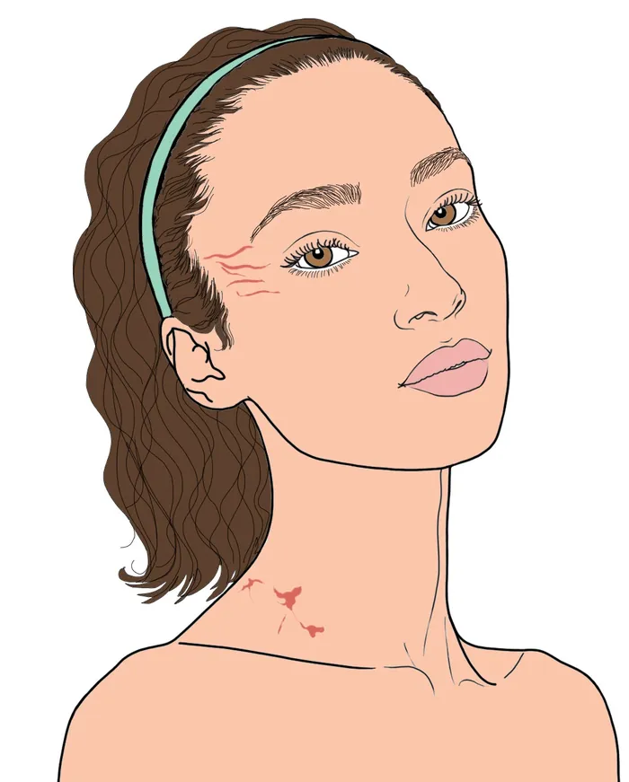 Woman with scars on face and neck in a digital illustration