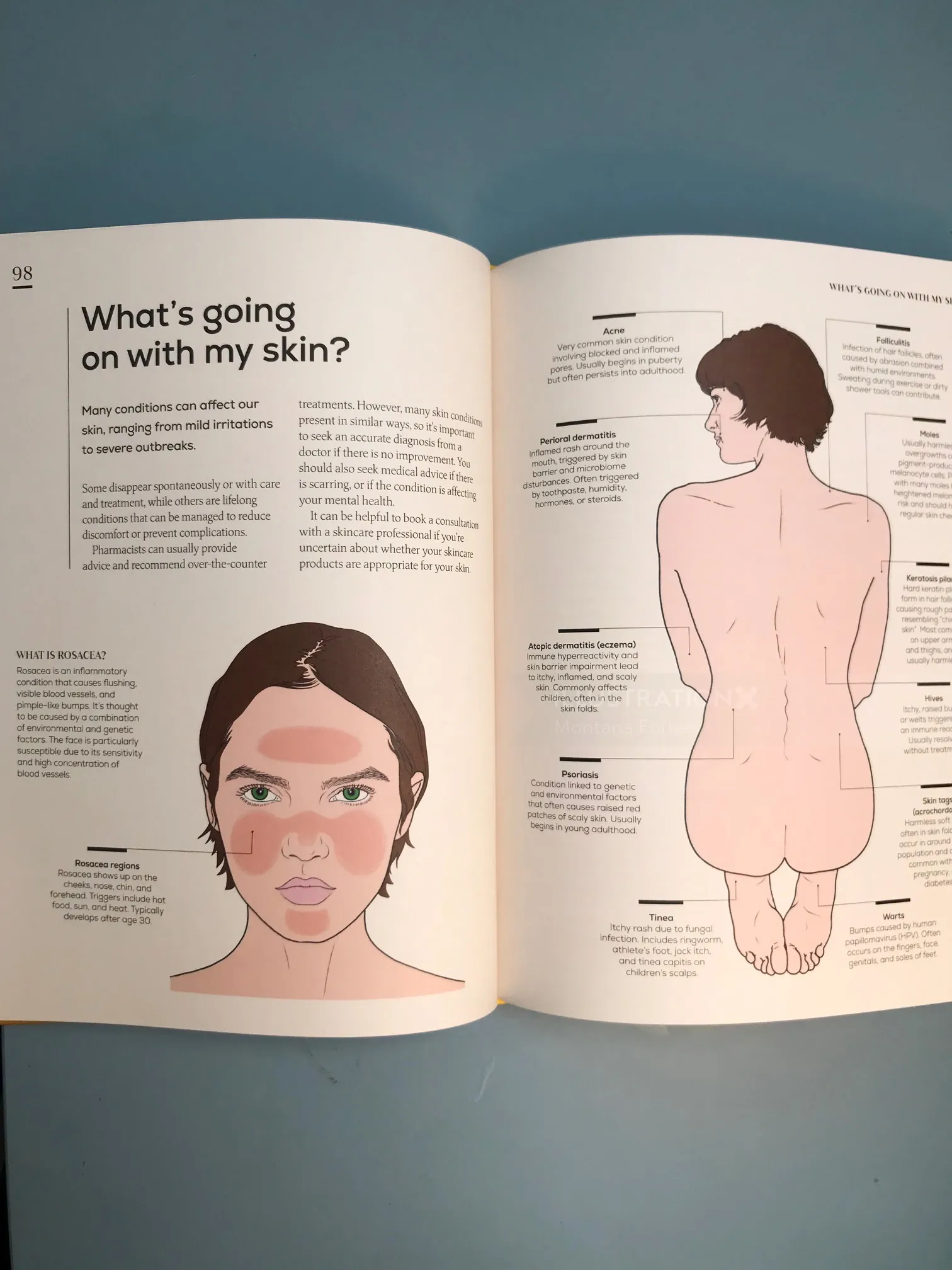 Diagram showing skin conditions on face and back with labels