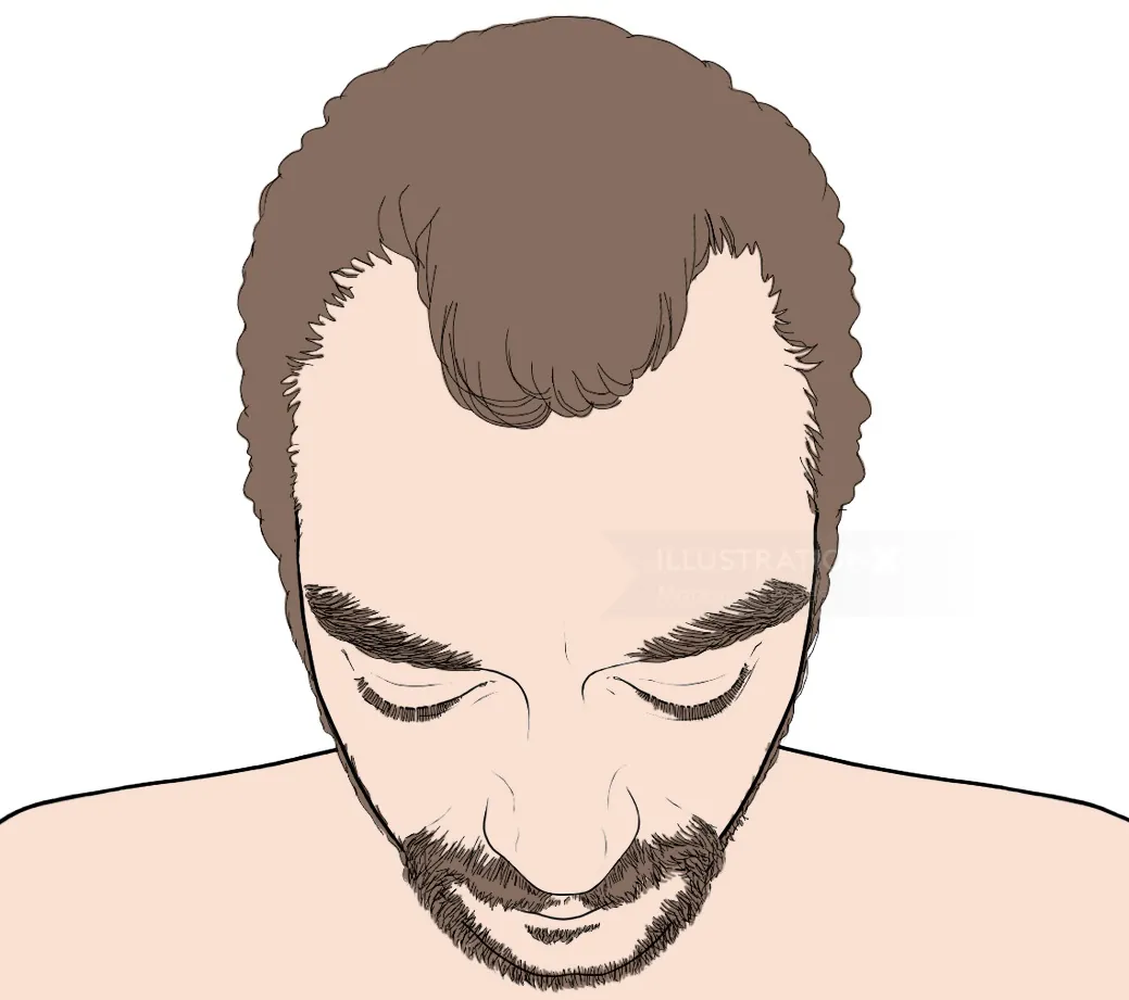 Top view of man with thinning hair and beard illustrated
