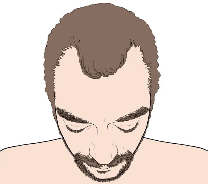 Top view of man with thinning hair and beard illustrated