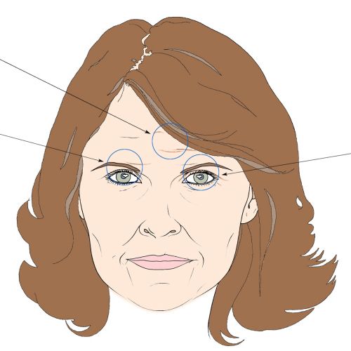 Line illustration of marked woman face
