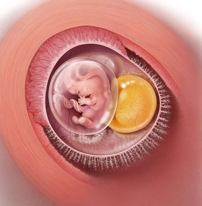 Early Pregnancy Failure: This month's cover illustration for Contemporary OB/GYN