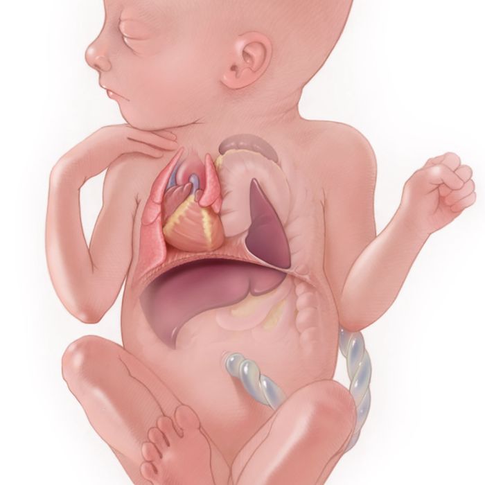 Cirurgia Fetal