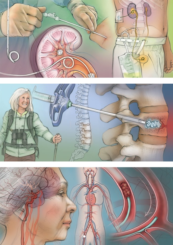 Informative art to explain medical procedures to patients