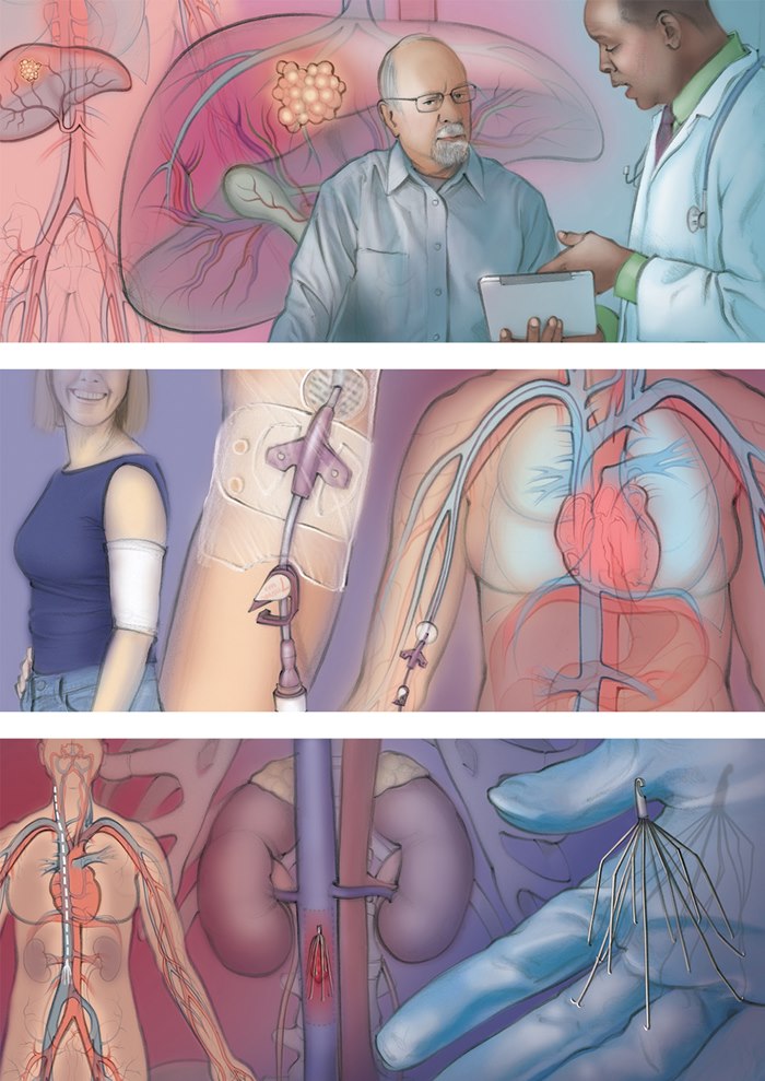 Juliet Percival's art explains medical procedures to patients