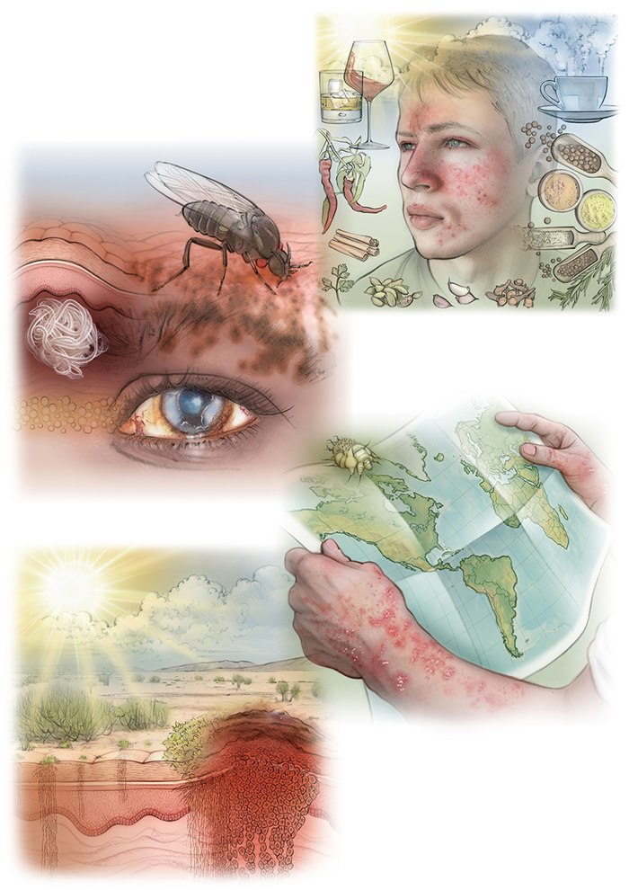 Medical illustration on skin diseases